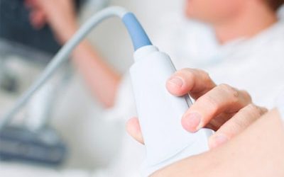 doppler-e-ecodoppler-em-ipanema